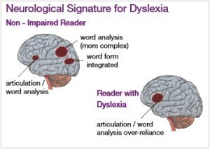 cellfield-brain-image